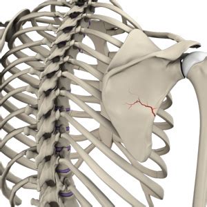 Shoulder Fracture NSW | Clavicle Fracture | Scapula Fracture NSW