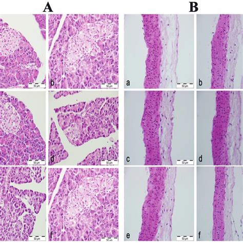 A Pancreas A Normoglycemic Control Group Normal Pancreas