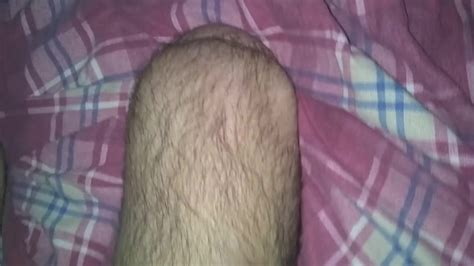 My Stumps Pornhub Gay