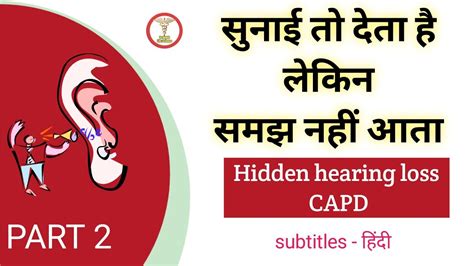 Capd Part 2 Ear Disease Hearing Loss Snhl Tinnitus Youtube