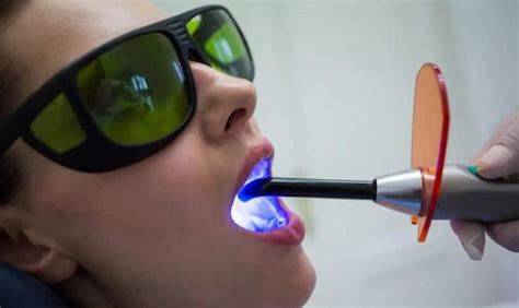 Everything You Need To Know About Laser Periodontal Therapy Lanap