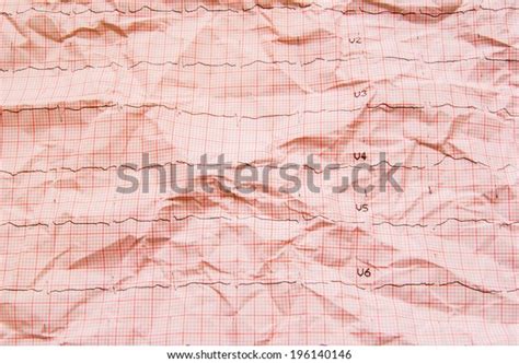 Electrocardiogram Ekg Stock Photo 196140146 Shutterstock