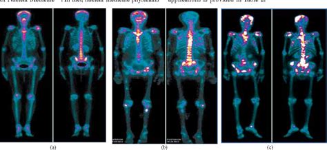 Pdf Applications Of Radioisotopes In Medicine Semantic Scholar