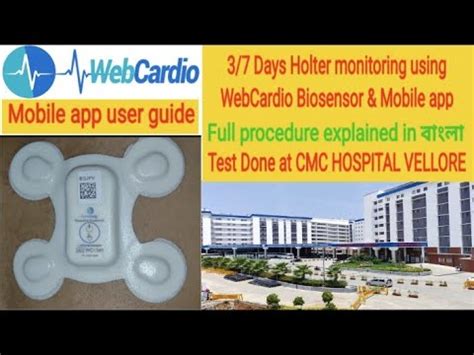 Days Holter Monitoring Using Webcardio Biosensor App Full