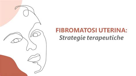 Trattamento Dei Fibromi Uterini YouTube