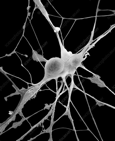 Pyramidal Neurons From Cns Sem Stock Image C Science