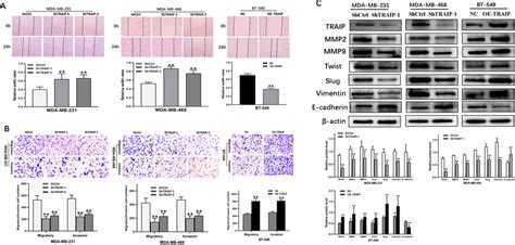 Traip Knockdown Inhibits Tnbc Cell Lines Migration And Invasion By