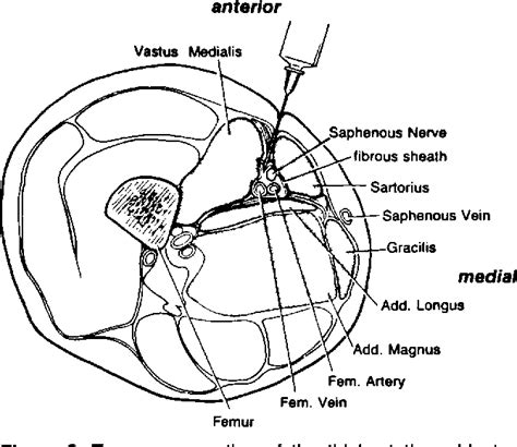 Figure 2 From Saphenous Nerve Entrapment At The Adductor Canal Semantic Scholar