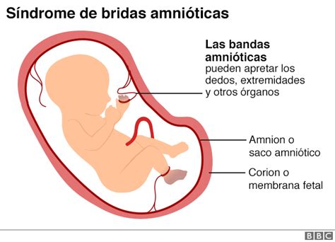 B Matrona Brunis