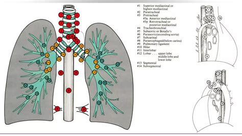 Contouring Of Ctv Lymph Nodes In Nsclc Part I Ppt Free Download