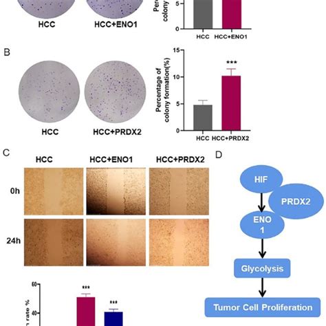 Eno1 And Prdx2 Promoted Proliferation And Migration Of Hcc Cell Line