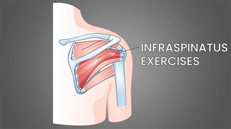 6 Best Infraspinatus Exercises With Pictures Inspire US