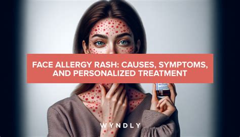 Allergic Reaction on Face: Symptoms & Treatments (2024) & Wyndly