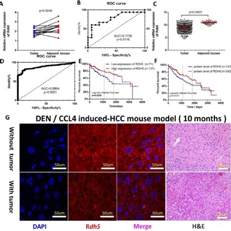 Rdh Is Down Regulation In Hcc Tissues And Its Expression Is Associated