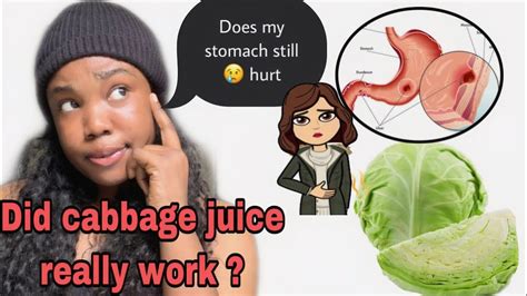 Drink Cabbage Juice For 3weeks To Cure Ulcerhow To Getter Results When