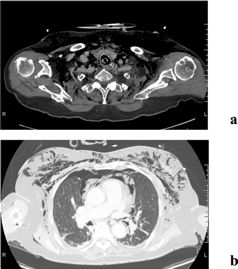 Figure 1 From Conservative Medical Management Combined With Follow Up