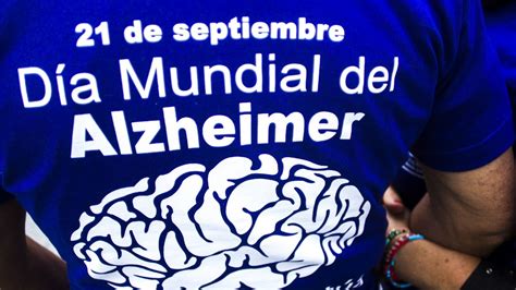 Alzheimer Enfermedad Neurodegenerativa M S N Ver Se Ales