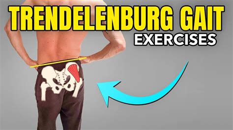 Exercises To Correct A Trendelenburg Gait Pattern Youtube