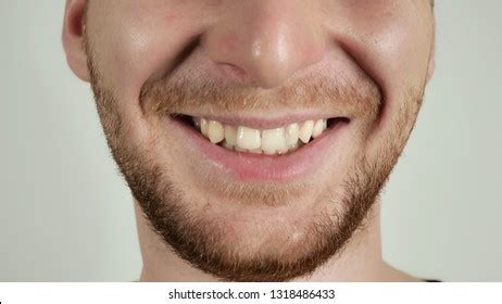 20 Unit Bq Veneers Stock Photo 1367974583 Shutterstock