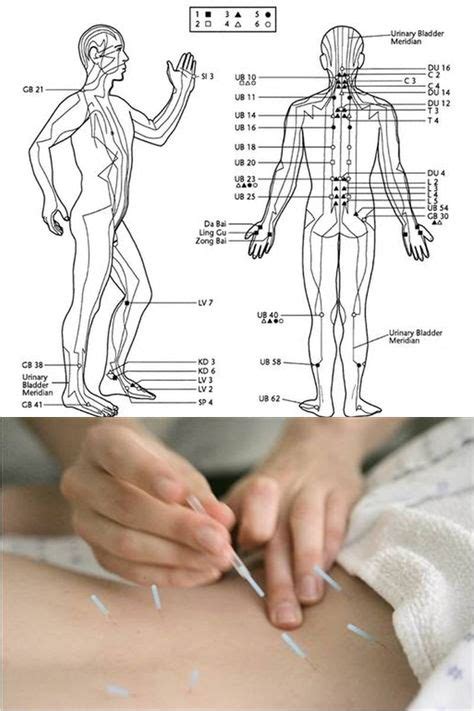 26 Acupuncture Ideas Acupuncture Acupressure Alternative Medicine