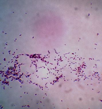 Tdr Tb Bacilli Isolated From Afb Culture Positive Samples