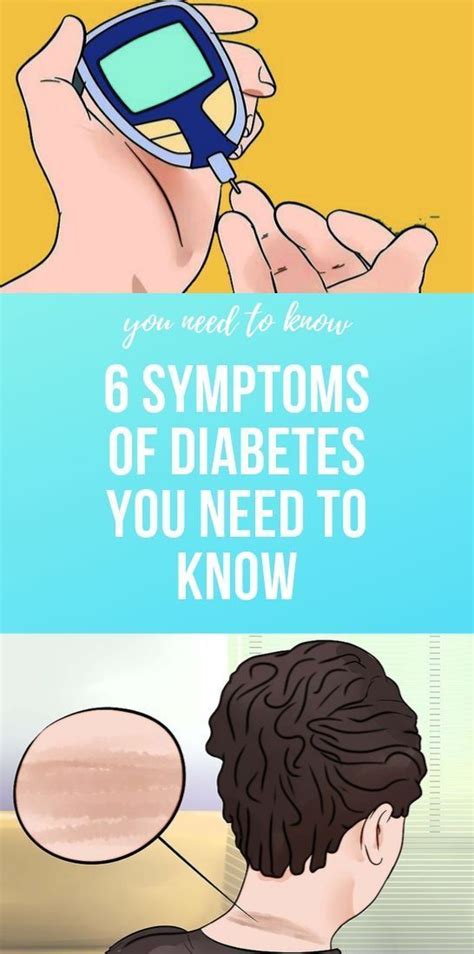 6 SYMPTOMS OF DIABETES YOU NEED TO KNOW