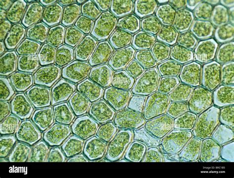 Light Micrograph LM Of Non Vascular Plant Liverwort Showing