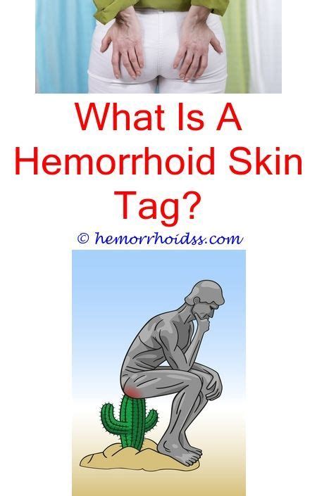 10 Alert Clever Hacks How To Remedy Hemorrhoids What Can You Put On