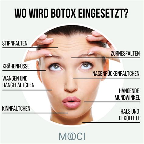 Botulinumtoxin Wirkung Kosten Risiken MOOCI Botox