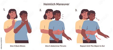 Choking First Aid For Adult Heimlich Maneuver Procedure To Remove Stock Vector Adobe Stock