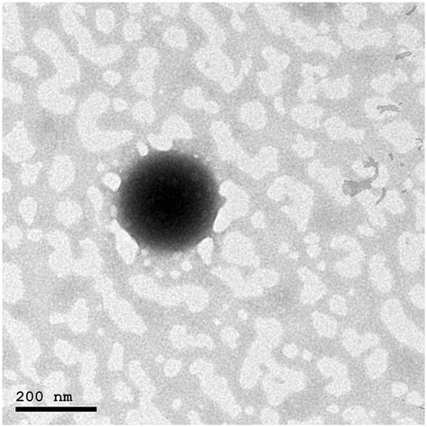 Transmission Electron Microscope Photograph Download Scientific Diagram