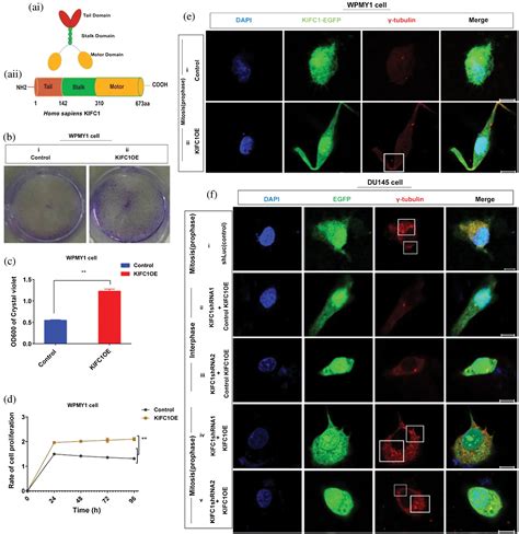 KIFC1 Overexpression Promotes Prostate Cancer Cell Survival And