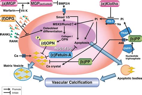 Coronary Artery Calcification From Mechanism To Molecular Imaging