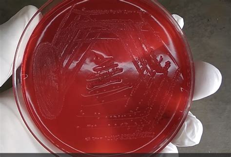 Shigella Boydii Growth On Xld Agar Archives Medical Notes