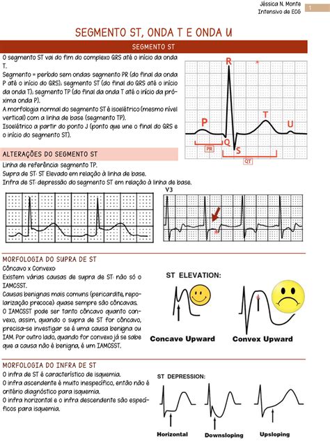 Ecg Infra De St BRAINCP