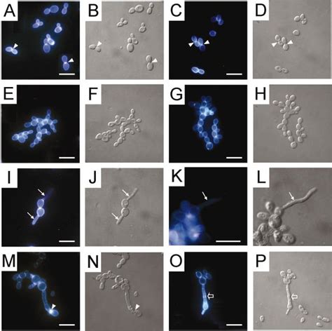 Chitin Distribution And Cell Morphologies Of Yeast Budding Cells A D