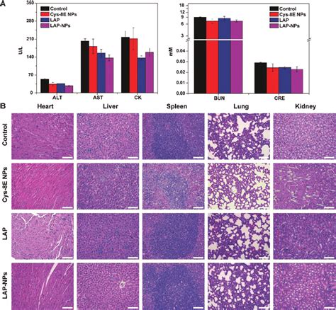 A Serum Levels Alt Ast Bun Ck And Cre Of T Tumor Bearing Mice