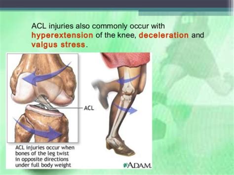 Musculoskeletal Pathology Knee And Hip Flashcards Quizlet