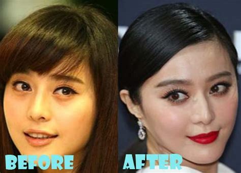 Fan Bingbing Plastic Surgery Before and After Photos - Lovely Surgery