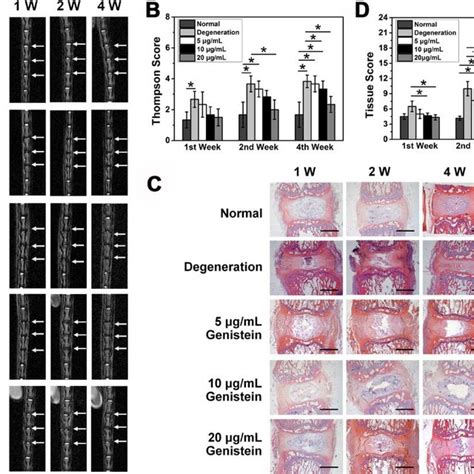 Genistein Inhibits Degradation And Inflammation Of Npcs In Vitro A