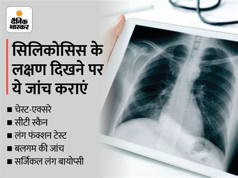 ICMR Silicosis Test Kit What Is Silicosis Disease In Hindi All You