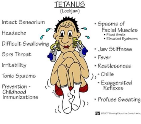 ClinMed Infectious Disease Botulism Tetanus Flashcards Quizlet