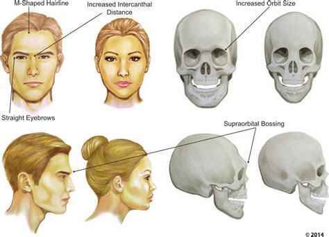 Feminine Face Vs Masculine Face