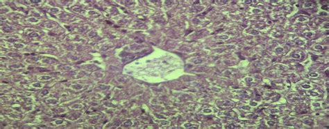 Cross Section Of Liver Control Group1 Showing Central Vein Cv