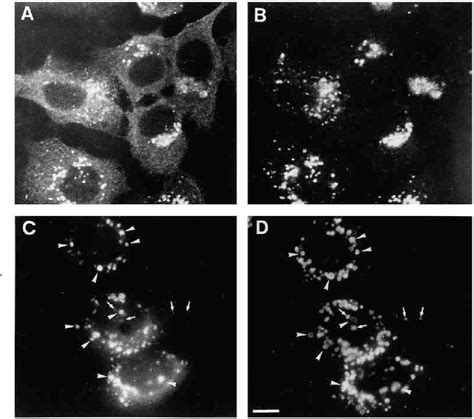 Figure 1 From A Human Intracellular Apyrase Like Protein LALP70