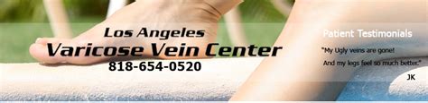 Varicose Vein Center Los Angeles California