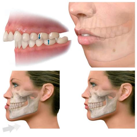 Cirugía oral y maxilofacial Beatriz Martín