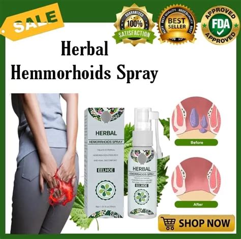 100 Effective Eelhoe Natural Herbal Hemorrhoids Spray Original Gamot