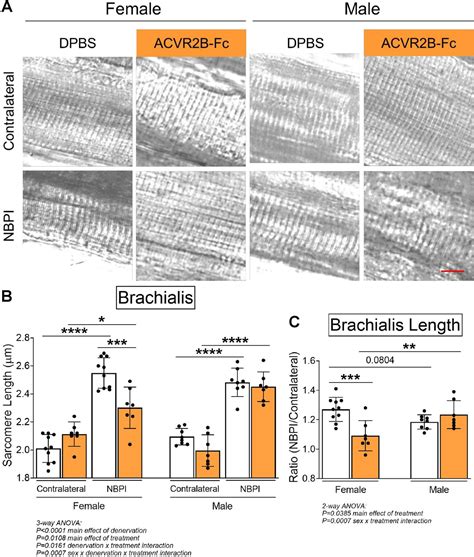 Sex Specific Role Of Myostatin Signaling In Neonatal Muscle Growth