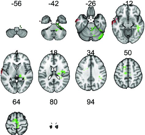 Regions Showing An Effect Of FTO On Resting Cerebral Blood Flow RCBF